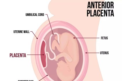 Anterior Placenta and Gender