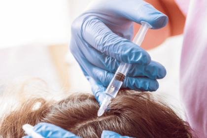 PRP Hair Treatment in Pakistan