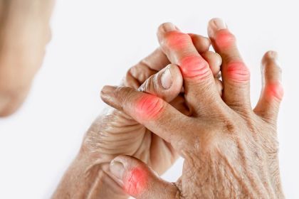 Rheumatoid Arthritis Treatments