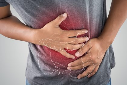 Ulcerative Colitis Treatments