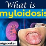 What is Amyloidosis