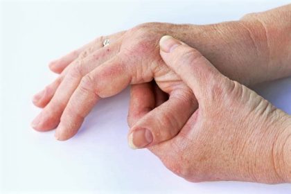 What is Arthritis