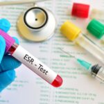 What is ESR
