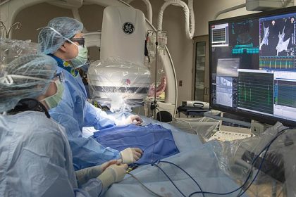 What is an Angiogram