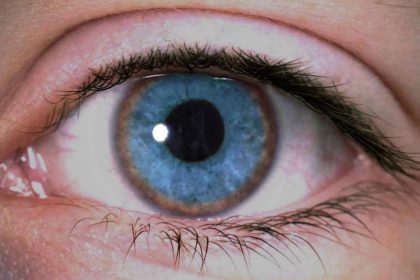 Wilson's Disease