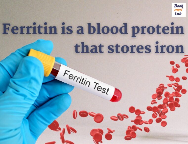 What is Ferritin Test? FAQs