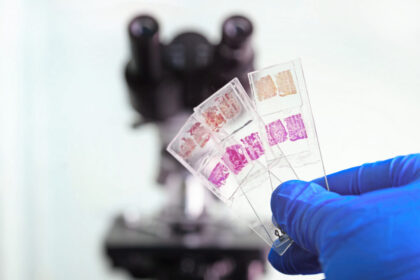The Risks of an IHC Test