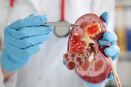 What Is a Nephrologist