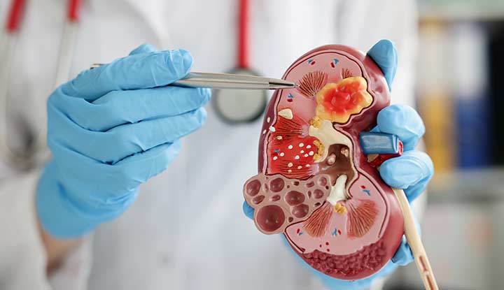 What Is a Nephrologist