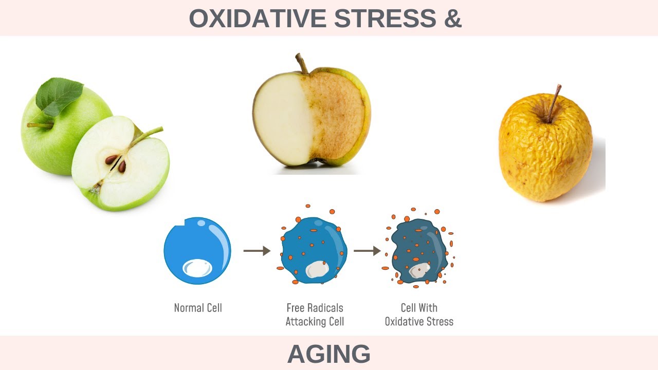 What is Oxidative Stress