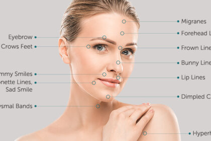 What Is Botox?