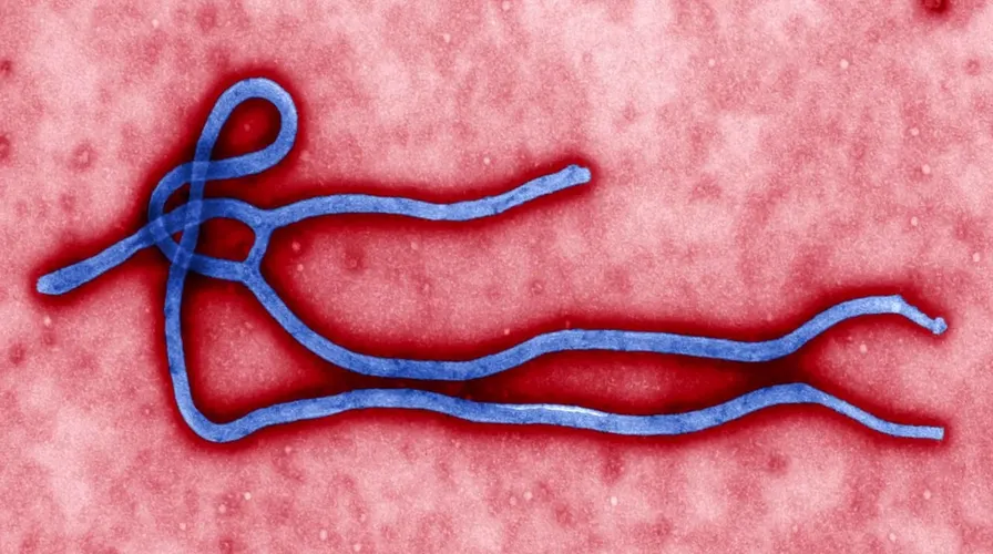 Marburg Virus Pakistan